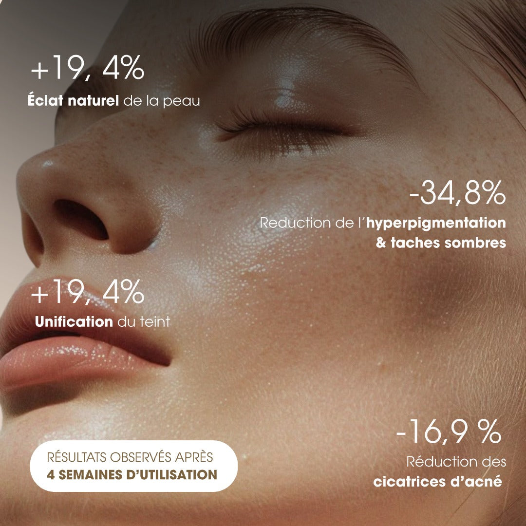 Savon anti-taches au curcuma ( 2 offerts + crème hydratante )