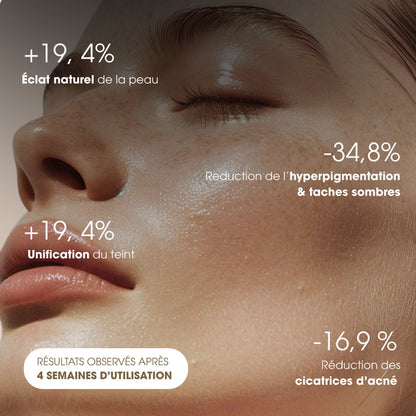 Savon anti-taches au curcuma ( 2 offerts + crème hydratante )